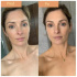 Gold Foaming Mousse2